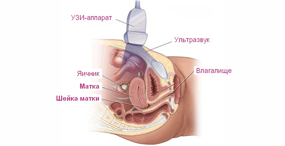 узи матки на какой день цикла делать